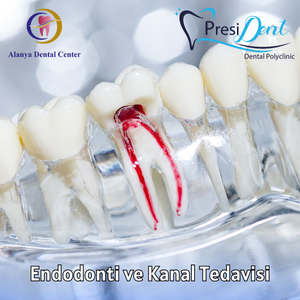 acıl dıs - diş çürüğü tedavisi fiyatları