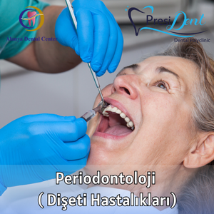 alanya diş eti hastalığı fiyatları