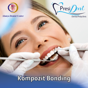 antalya bonding fiyatları