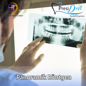 antalya çene cerrahi