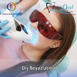 antalya diş beyazlatma ücreti