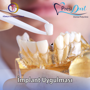 antalya implant fiyat