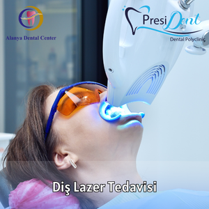 antalya lazer beyazlatma