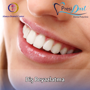 beyaz diş yaptırma