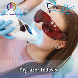diş lazer fiyatları