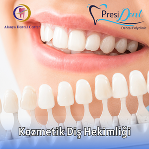 diş temizletme fiyatları antalya