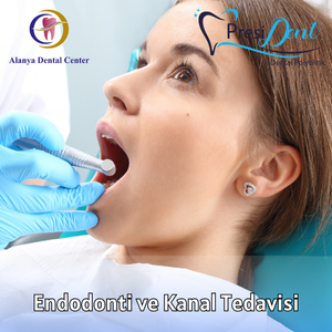 güncel kanal tedavisi fiyatları