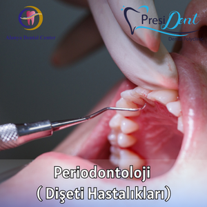 periodontoloji antalya