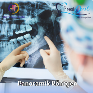 xray panoramik antalya fiyat