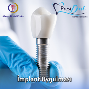 yerli implant fiyatları
